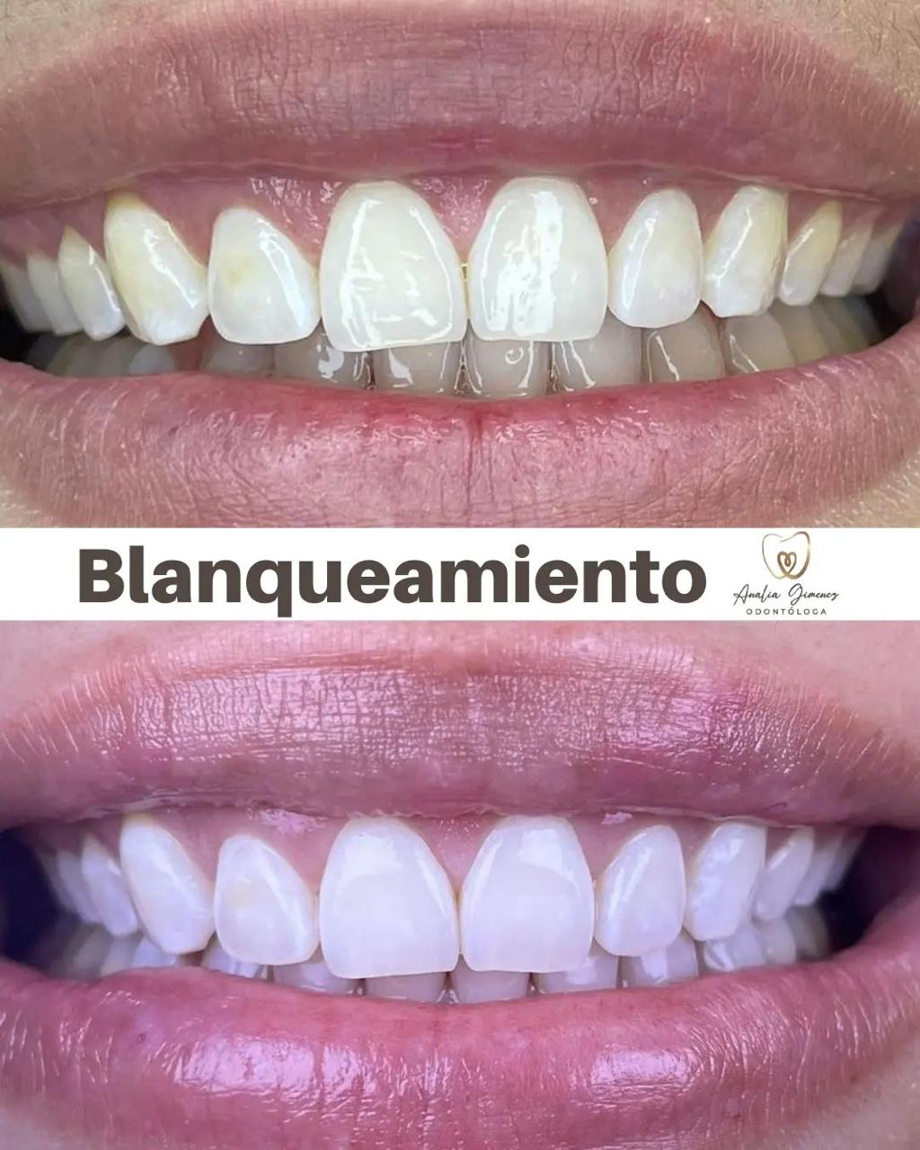 Tratamiento 6