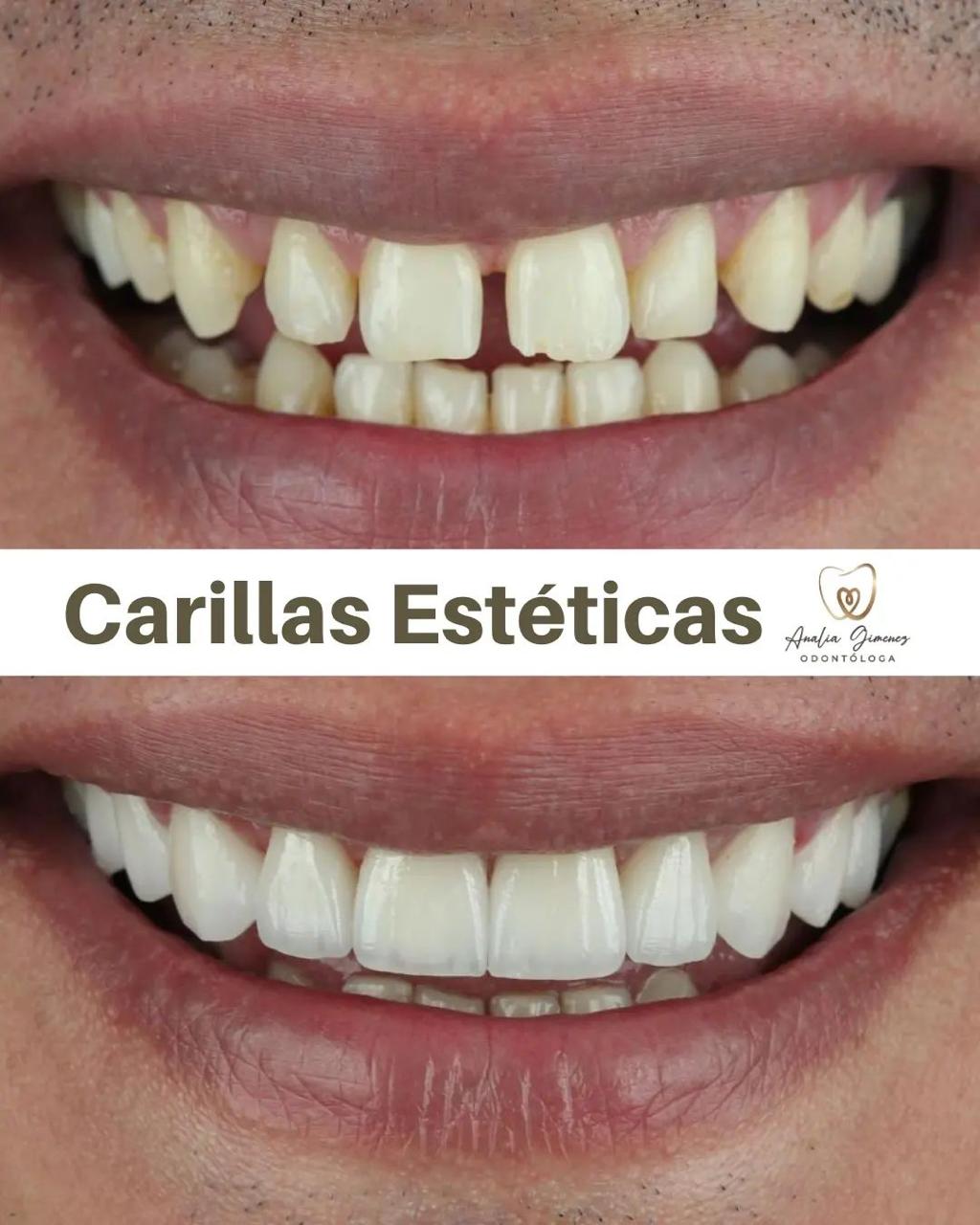 Tratamiento 2